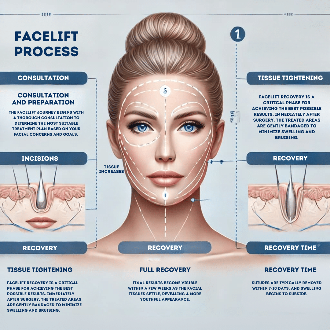 The Facelift Process What to Expect