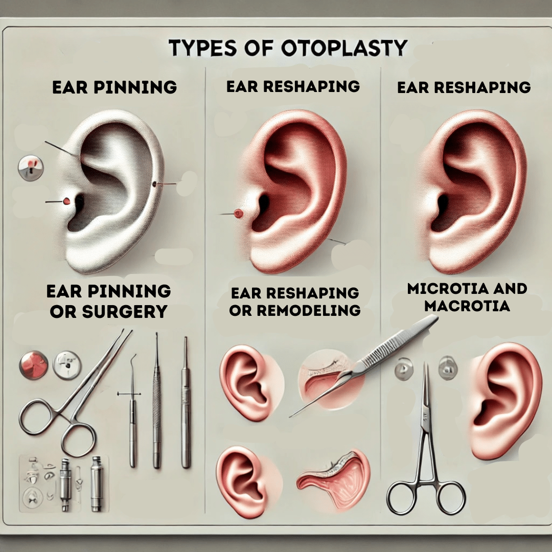 Types of Otoplasty Procedures