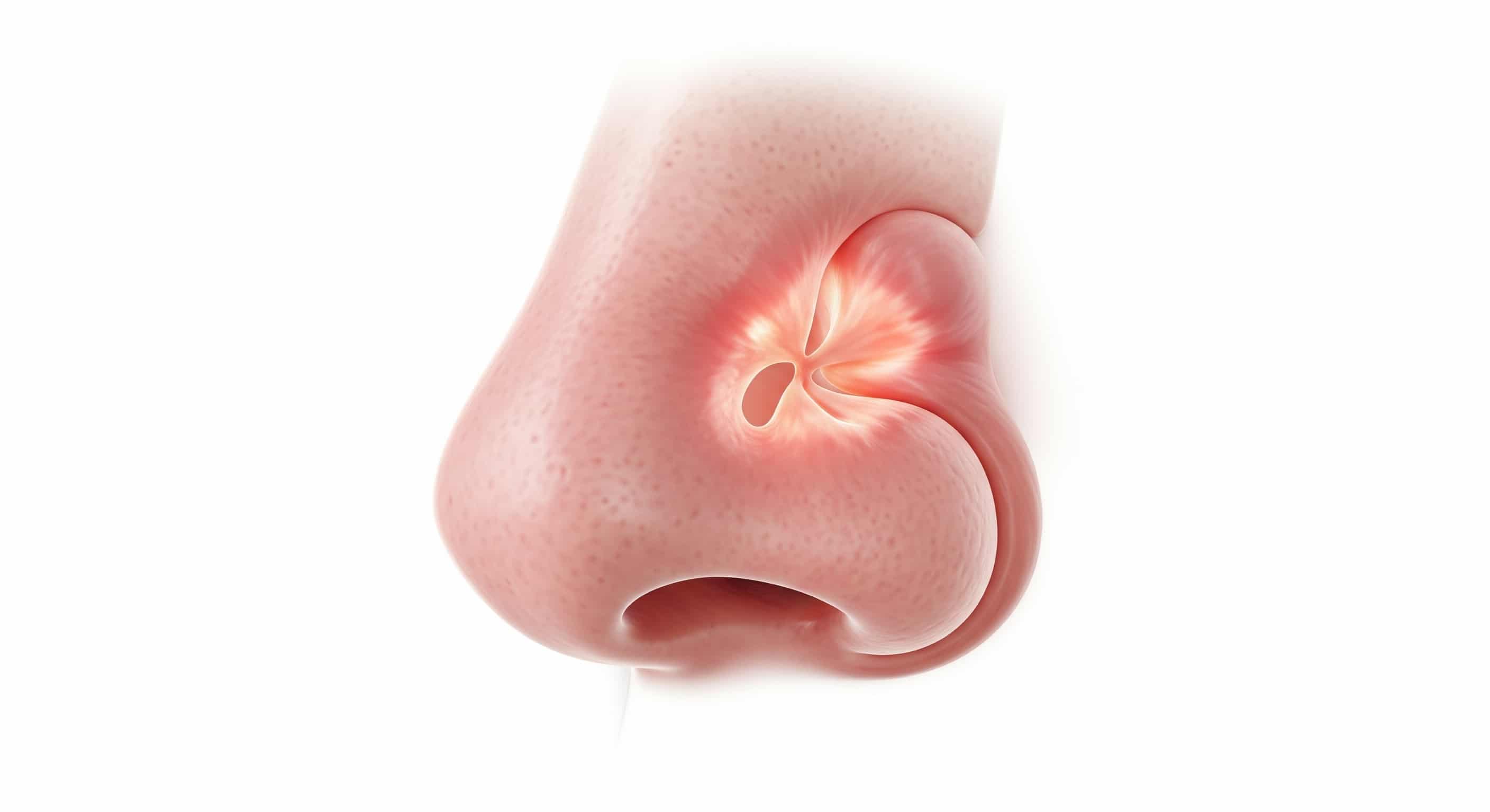 Chronic Sinus Infection Treatment Surgery | Zandifar MD