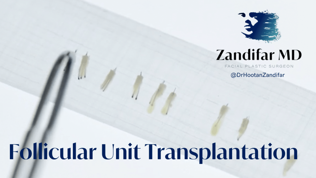 Follicular Unit Transplantation with Dr. Hootan Zandifar of Zandifar MD. FUT extractions before they are transplanted into the scalp showing individual hair follicles.