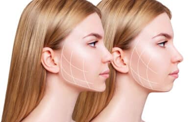 The Science Behind Non-Surgical Skin Tightening Procedures