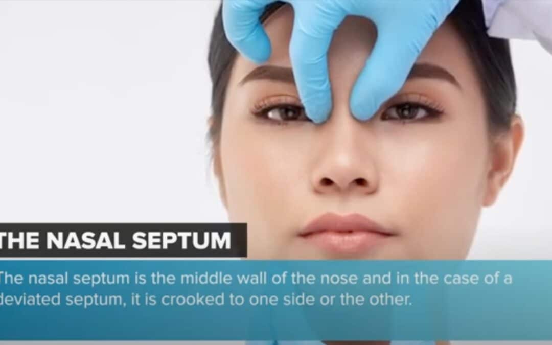 Breathing Easier: Unveiling the Intricacies of Septoplasty