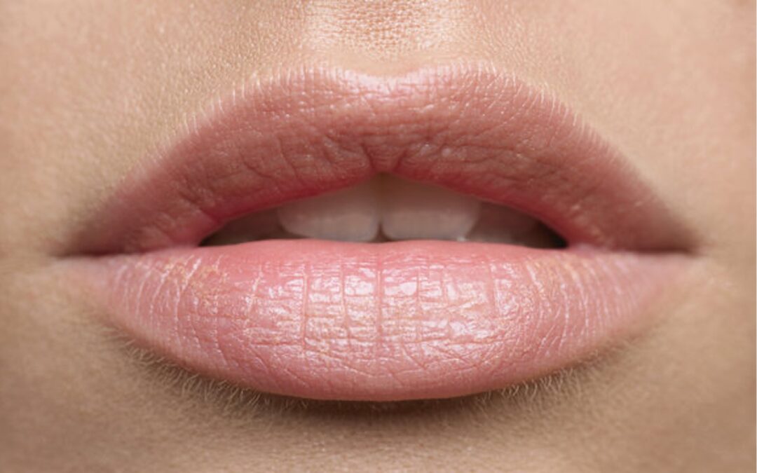 The Art of Natural-Looking Lip Augmentation: A Harmony of Science and Aesthetics