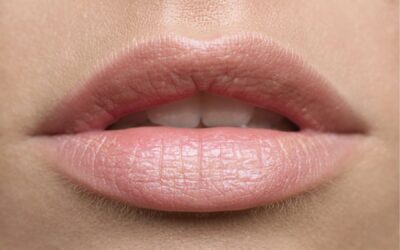 The Art of Natural-Looking Lip Augmentation: A Harmony of Science and Aesthetics