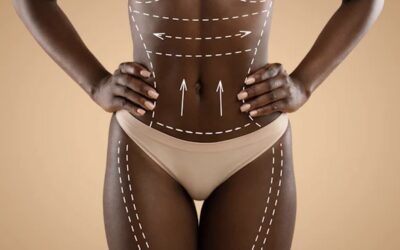 Body Contouring 101: Liposuction vs. Tummy Tuck